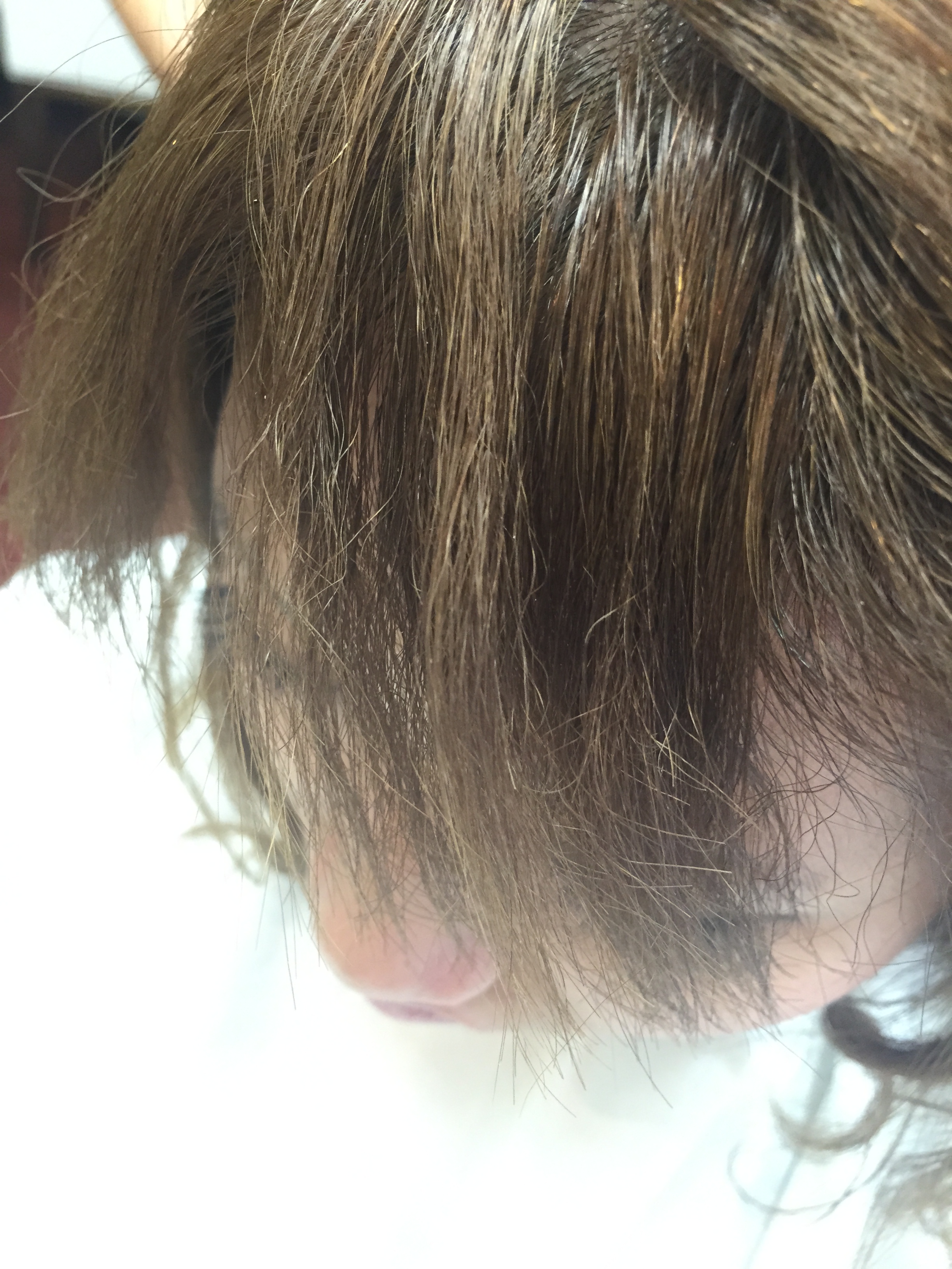 ビビリ毛修繕 縮毛矯正 デジタルパーマ ブリーチで髪が傷み切り チリチリ バサバサになってしまった髪の施術例 京都 東京の美容室 縮毛矯正 ダメージ毛 ヘアケアに専門特化した藤原隆一の美容師ブログ